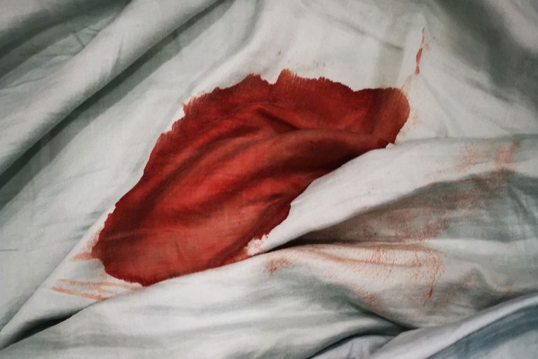 What Happens If You Get Blood on Hotel Sheets?